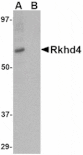 Western blot - Rkhd4 Antibody from Signalway Antibody (24782) - Antibodies.com