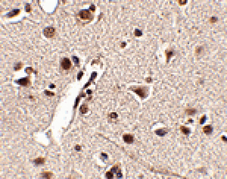 Immunohistochemistry - Rkhd4 Antibody from Signalway Antibody (24782) - Antibodies.com