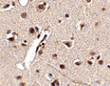 Immunohistochemistry - Rkhd4 Antibody from Signalway Antibody (24782) - Antibodies.com