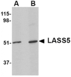Western blot - LASS5 Antibody from Signalway Antibody (24801) - Antibodies.com