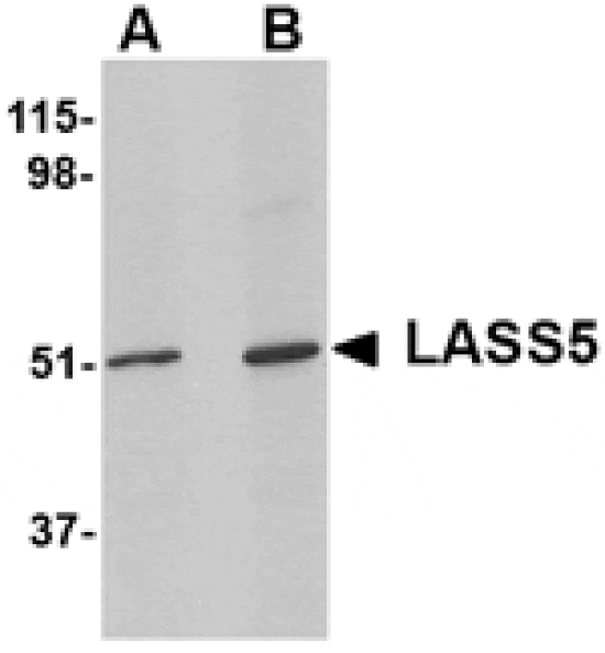 Western blot - LASS5 Antibody from Signalway Antibody (24801) - Antibodies.com