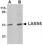 Western blot - LASS5 Antibody from Signalway Antibody (24801) - Antibodies.com