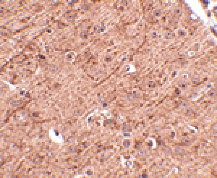 Immunohistochemistry - LASS5 Antibody from Signalway Antibody (24801) - Antibodies.com