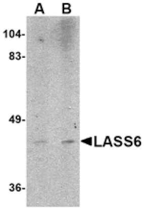 Western blot - LASS6 Antibody from Signalway Antibody (24802) - Antibodies.com
