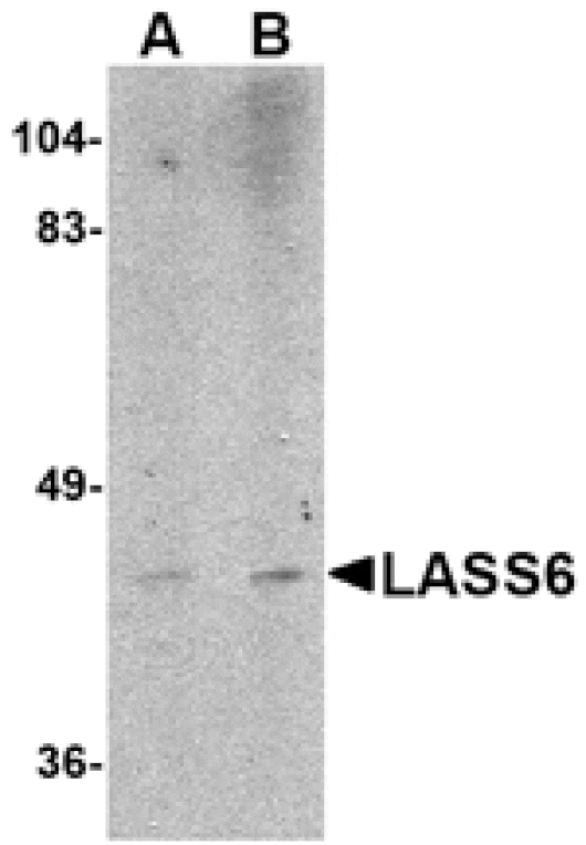 Western blot - LASS6 Antibody from Signalway Antibody (24802) - Antibodies.com
