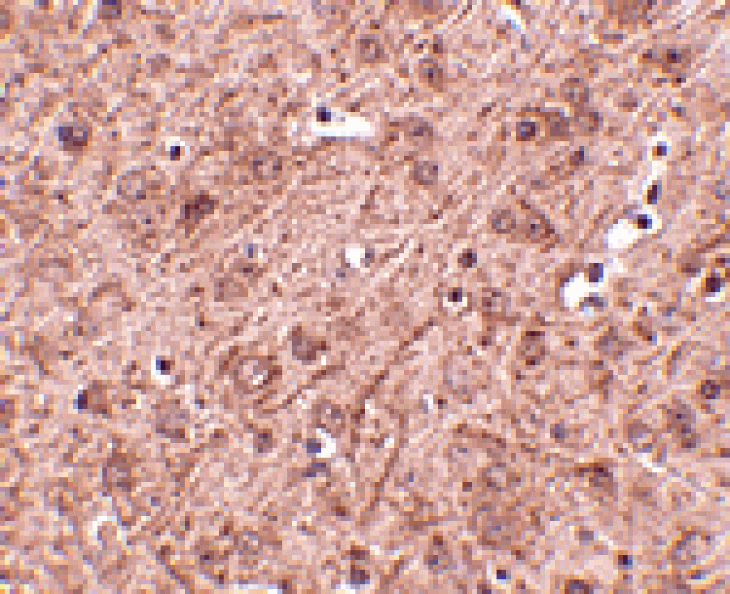 Immunohistochemistry - LASS6 Antibody from Signalway Antibody (24802) - Antibodies.com