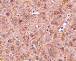Immunohistochemistry - LASS6 Antibody from Signalway Antibody (24802) - Antibodies.com