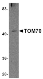 Western blot - TOM70 Antibody from Signalway Antibody (24806) - Antibodies.com