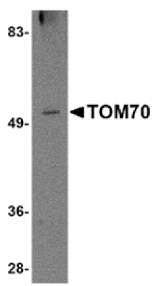 Western blot - TOM70 Antibody from Signalway Antibody (24806) - Antibodies.com