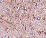 Immunohistochemistry - TOM70 Antibody from Signalway Antibody (24806) - Antibodies.com