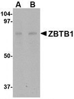 Western blot analysis of ZBTB1 in HepG2 lysate with ZBTB1 antibody at (A) 1 and (B) 2 µg/mL.