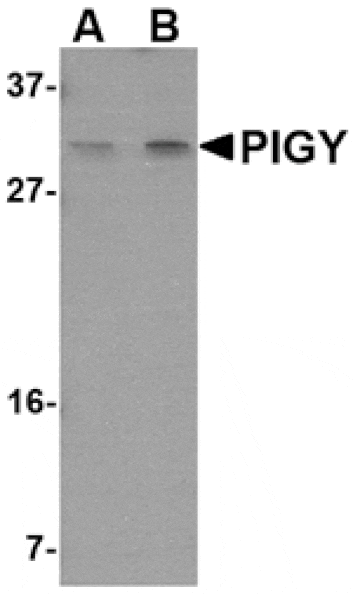 Western blot - PIG-Y Antibody from Signalway Antibody (24809) - Antibodies.com