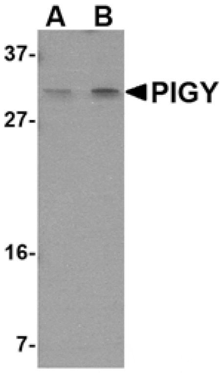 Western blot - PIG-Y Antibody from Signalway Antibody (24809) - Antibodies.com