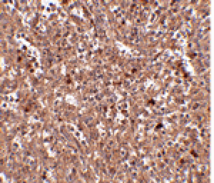 Immunohistochemistry - PIG-Y Antibody from Signalway Antibody (24809) - Antibodies.com