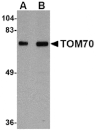 Western blot - TOM70 Antibody from Signalway Antibody (24811) - Antibodies.com