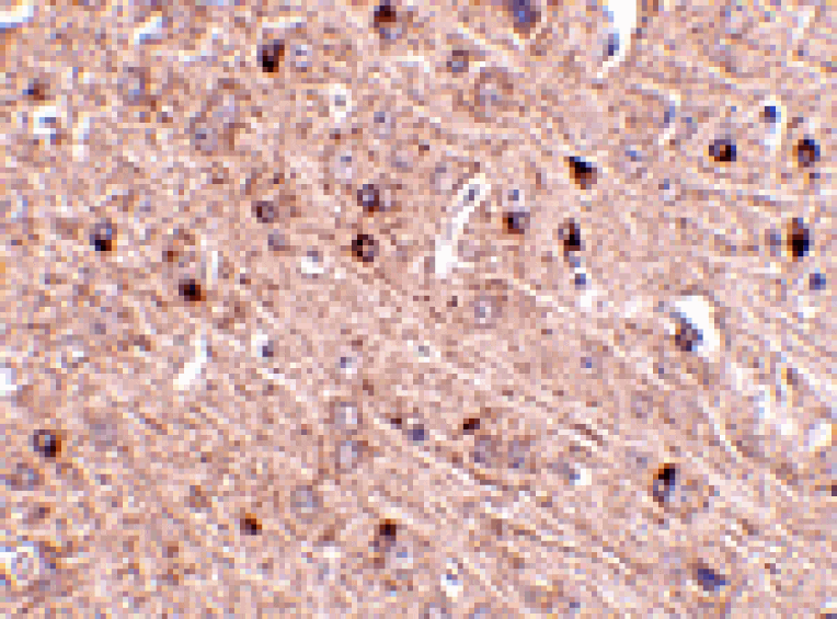 Immunohistochemistry - TOM70 Antibody from Signalway Antibody (24811) - Antibodies.com