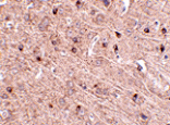 Immunohistochemistry - TOM70 Antibody from Signalway Antibody (24811) - Antibodies.com