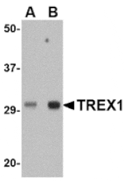 Western blot - TREX1 Antibody from Signalway Antibody (24815) - Antibodies.com