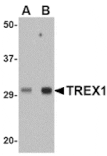 Western blot - TREX1 Antibody from Signalway Antibody (24815) - Antibodies.com