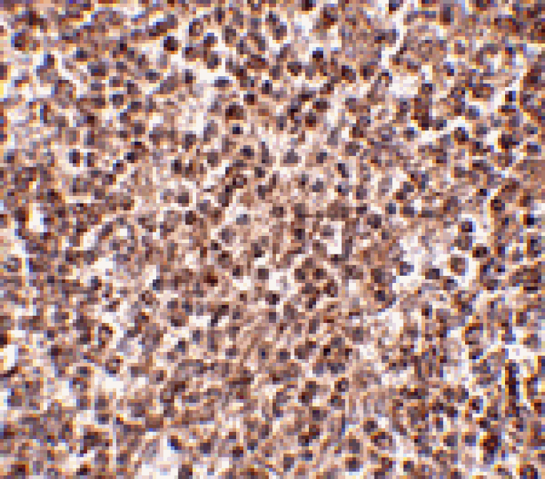 Immunohistochemistry - TREX1 Antibody from Signalway Antibody (24815) - Antibodies.com