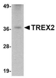 Western blot - TREX2 Antibody from Signalway Antibody (24816) - Antibodies.com
