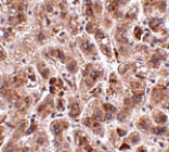 Immunohistochemistry - TREX2 Antibody from Signalway Antibody (24816) - Antibodies.com
