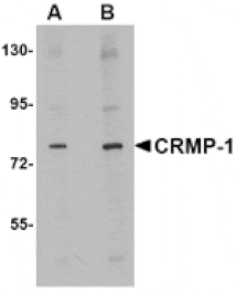 Western blot - CRMP1 Antibody from Signalway Antibody (24820) - Antibodies.com