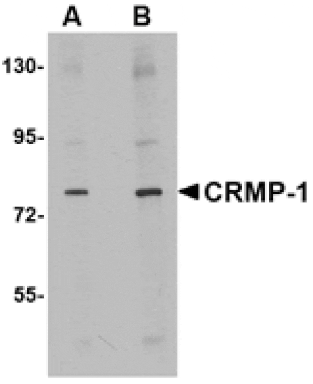 Western blot - CRMP1 Antibody from Signalway Antibody (24820) - Antibodies.com