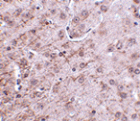 Immunohistochemistry - CRMP1 Antibody from Signalway Antibody (24820) - Antibodies.com