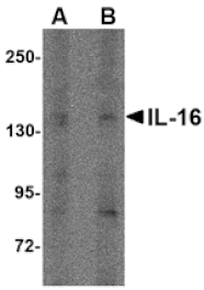 Western blot - IL-16 Antibody from Signalway Antibody (24821) - Antibodies.com