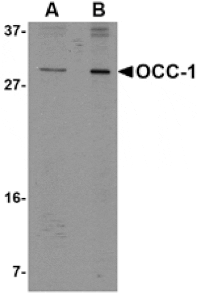 Western blot - OCC-1 Antibody from Signalway Antibody (24822) - Antibodies.com