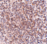 Immunohistochemistry - OCC-1 Antibody from Signalway Antibody (24822) - Antibodies.com