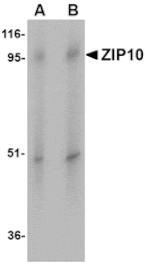 Western blot - ZIP10 Antibody from Signalway Antibody (24824) - Antibodies.com