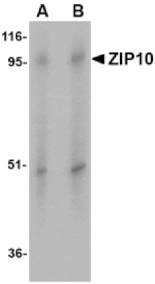 Western blot - ZIP10 Antibody from Signalway Antibody (24824) - Antibodies.com