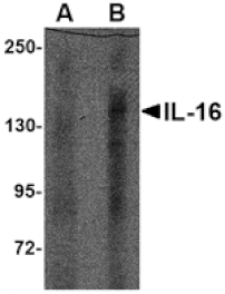 Western blot - IL-16 Antibody from Signalway Antibody (24826) - Antibodies.com