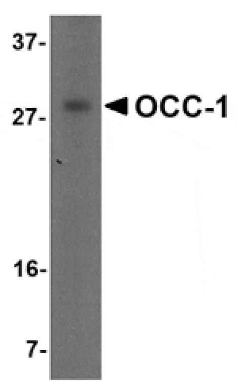 Western blot - OCC-1 Antibody from Signalway Antibody (24827) - Antibodies.com