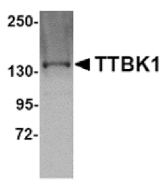 Western blot - TTBK1 Antibody from Signalway Antibody (24835) - Antibodies.com