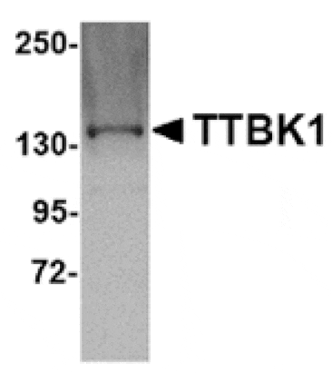 Western blot - TTBK1 Antibody from Signalway Antibody (24835) - Antibodies.com