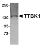 Western blot - TTBK1 Antibody from Signalway Antibody (24835) - Antibodies.com