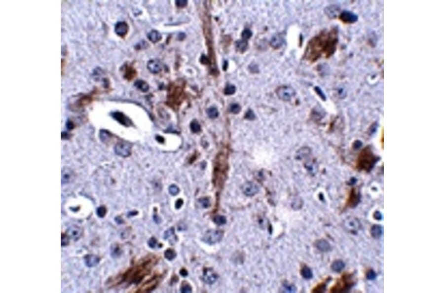 Immunohistochemistry - TTBK1 Antibody from Signalway Antibody (24835) - Antibodies.com