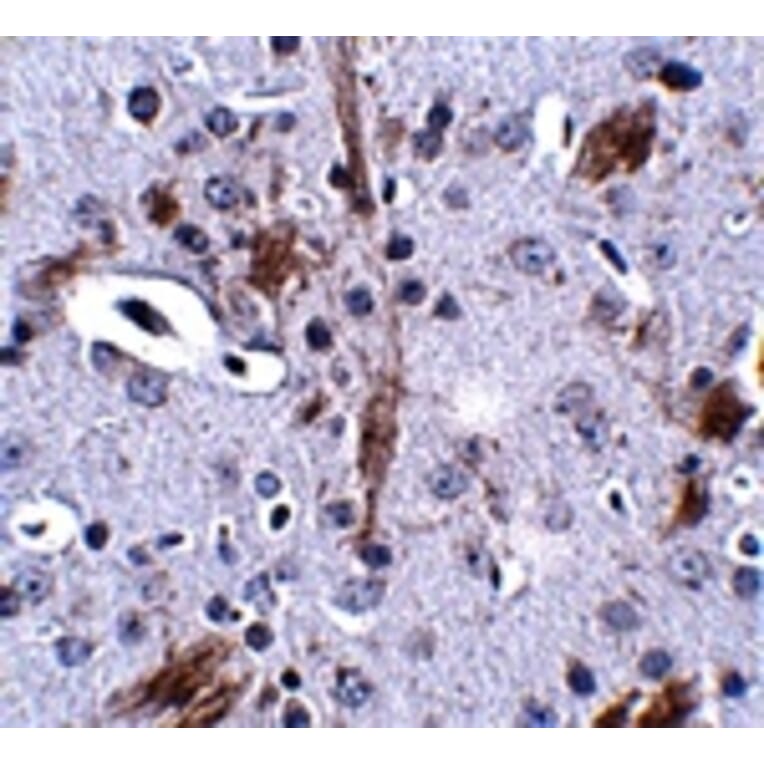 Immunohistochemistry - TTBK1 Antibody from Signalway Antibody (24835) - Antibodies.com