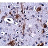 Immunohistochemistry - TTBK1 Antibody from Signalway Antibody (24835) - Antibodies.com