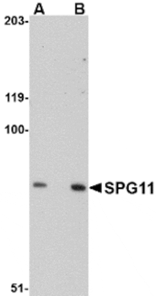 Western blot - SPG11 Antibody from Signalway Antibody (24836) - Antibodies.com