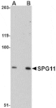 Western blot - SPG11 Antibody from Signalway Antibody (24836) - Antibodies.com