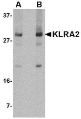 Western blot - KLRA2 Antibody from Signalway Antibody (24837) - Antibodies.com