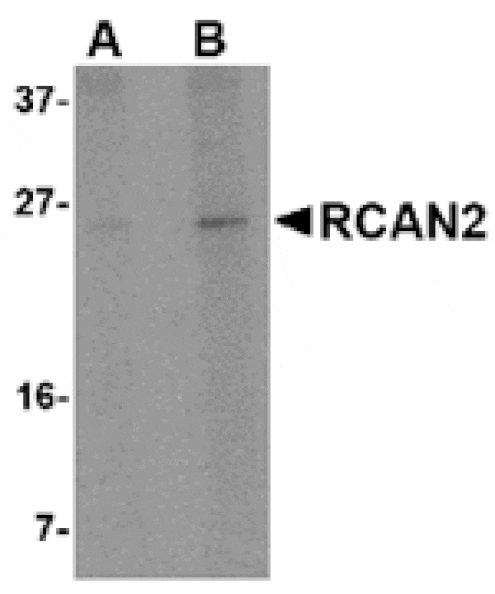 Western blot - RCAN2 Antibody from Signalway Antibody (24846) - Antibodies.com