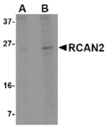 Western blot - RCAN2 Antibody from Signalway Antibody (24846) - Antibodies.com