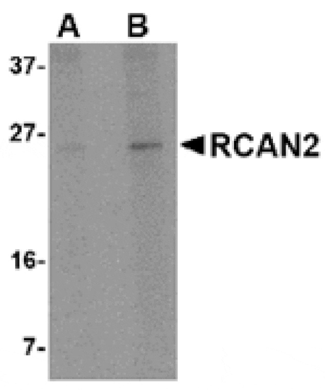 Western blot - RCAN2 Antibody from Signalway Antibody (24846) - Antibodies.com