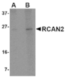 Western blot - RCAN2 Antibody from Signalway Antibody (24846) - Antibodies.com