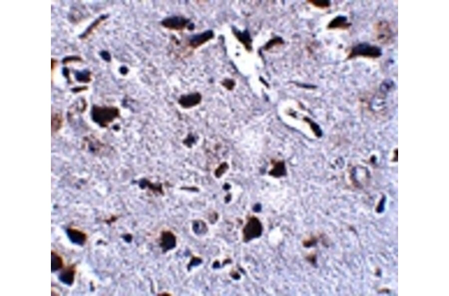Immunohistochemistry - RCAN2 Antibody from Signalway Antibody (24846) - Antibodies.com